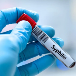SALUD: ¿Qué es la sífilis? Preocupa el aumento en tasa de contagio en personas mayores.