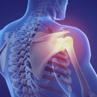 Fibromialgia: cuando el dolor crónico hace invisible lo visible, afecta entre el 2% y el 5% de la población.