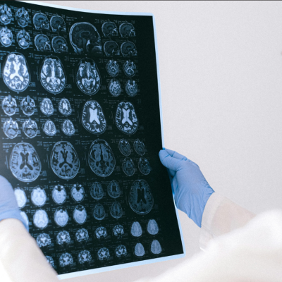 Investigación estudia cómo el cerebro adquiere experticia visual al procesar imágenes.