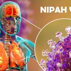 Rebrote de Virus Nipah en India, alerta sin alarmismo y el valor de la prevención.