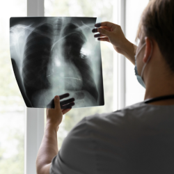 SALUD: Enfermedad Pulmonar Obstructiva Crónica: cuáles son sus causas y riesgos.