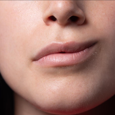 SALUD: La importancia de reconocer los signos de una parálisis facial periférica.