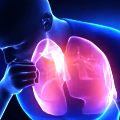 SALUD: Tuberculosis: principal causa de muerte en el mundo por enfermedades infecciosas.