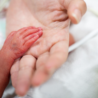 SALUD: Beneficios para el recién nacido prematuro, cada año nacen 15 millones en el mundo.