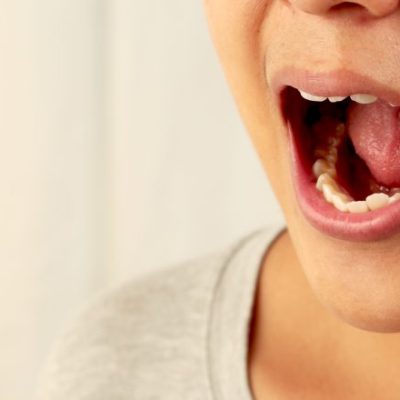 SALUD: ¿Cómo se manifiesta el cáncer oral y cuándo acudir al médico?